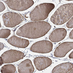 CFAP61 Antibody in Immunohistochemistry (Paraffin) (IHC (P))