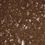 ICAM-5 Polyclonal Antibody