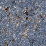 CLCC1 Antibody in Immunohistochemistry (IHC)