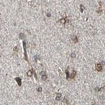 CLCC1 Antibody in Immunohistochemistry (IHC)