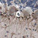 CLCC1 Antibody in Immunohistochemistry (IHC)