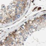 CLCC1 Antibody in Immunohistochemistry (IHC)