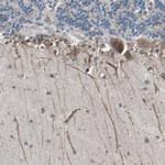 CLCC1 Antibody in Immunohistochemistry (IHC)