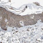 PNPLA7 Antibody in Immunohistochemistry (IHC)