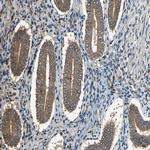 PNPLA7 Antibody in Immunohistochemistry (IHC)