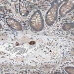 PNPLA7 Polyclonal Antibody