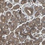 PNPLA7 Antibody in Immunohistochemistry (IHC)