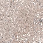 COL12A1 Antibody in Immunohistochemistry (IHC)