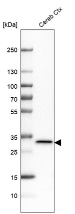 LHPP Antibody in Western Blot (WB)