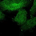 SHOC2 Polyclonal Antibody