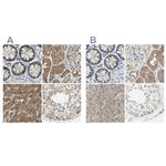 LHPP Polyclonal Antibody