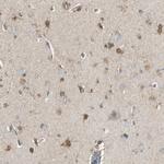 LHPP Antibody in Immunohistochemistry (IHC)