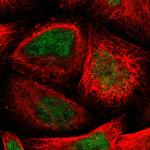 TTC14 Polyclonal Antibody