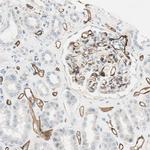 CD93 Antibody in Immunohistochemistry (IHC)