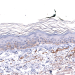 Laminin alpha-3 Antibody in Immunohistochemistry (Paraffin) (IHC (P))