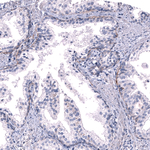 Laminin alpha-3 Antibody in Immunohistochemistry (Paraffin) (IHC (P))