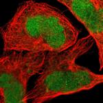 JPH1 Antibody in Immunocytochemistry (ICC/IF)