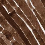 JPH1 Antibody in Immunohistochemistry (Paraffin) (IHC (P))