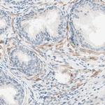 JPH1 Antibody in Immunohistochemistry (IHC)
