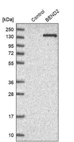 BEND2 Antibody in Western Blot (WB)
