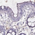 DPEP1 Antibody in Immunohistochemistry (IHC)