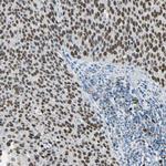 ZNF306 Antibody in Immunohistochemistry (Paraffin) (IHC (P))