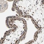 ZNF306 Antibody in Immunohistochemistry (Paraffin) (IHC (P))
