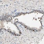 ZNF306 Antibody in Immunohistochemistry (Paraffin) (IHC (P))