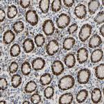 ZNF306 Polyclonal Antibody