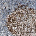ZNF306 Antibody in Immunohistochemistry (Paraffin) (IHC (P))