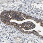 GRAMD3 Antibody in Immunohistochemistry (Paraffin) (IHC (P))