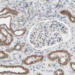 GRAMD3 Antibody in Immunohistochemistry (Paraffin) (IHC (P))