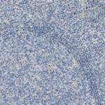 GRAMD3 Antibody in Immunohistochemistry (Paraffin) (IHC (P))