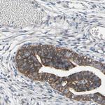 GRAMD3 Antibody in Immunohistochemistry (IHC)