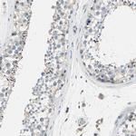 GRAMD3 Antibody in Immunohistochemistry (IHC)