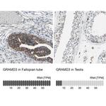 GRAMD3 Antibody