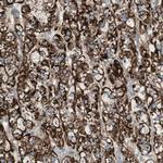 SNIP Polyclonal Antibody