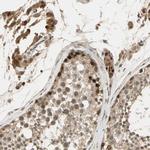 GMEB2 Antibody in Immunohistochemistry (IHC)