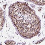 RMDN3 Antibody in Immunohistochemistry (Paraffin) (IHC (P))