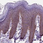 RMDN3 Antibody in Immunohistochemistry (IHC)