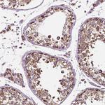 RMDN3 Antibody in Immunohistochemistry (IHC)