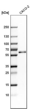 RMDN3 Antibody in Western Blot (WB)