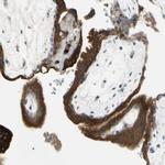 ANGPTL1 Antibody in Immunohistochemistry (IHC)