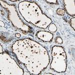 ANGPTL1 Antibody in Immunohistochemistry (IHC)