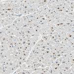 ANGPTL1 Antibody in Immunohistochemistry (IHC)