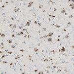 ANGPTL1 Antibody in Immunohistochemistry (IHC)