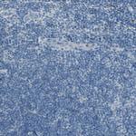 ANGPTL1 Polyclonal Antibody