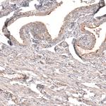MTM1 Antibody in Immunohistochemistry (IHC)