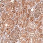 MTM1 Antibody in Immunohistochemistry (IHC)