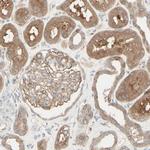 MTM1 Antibody in Immunohistochemistry (IHC)